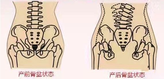 产后修复盆底肌漏尿怎么治疗,产后修复盆底肌漏尿怎么办