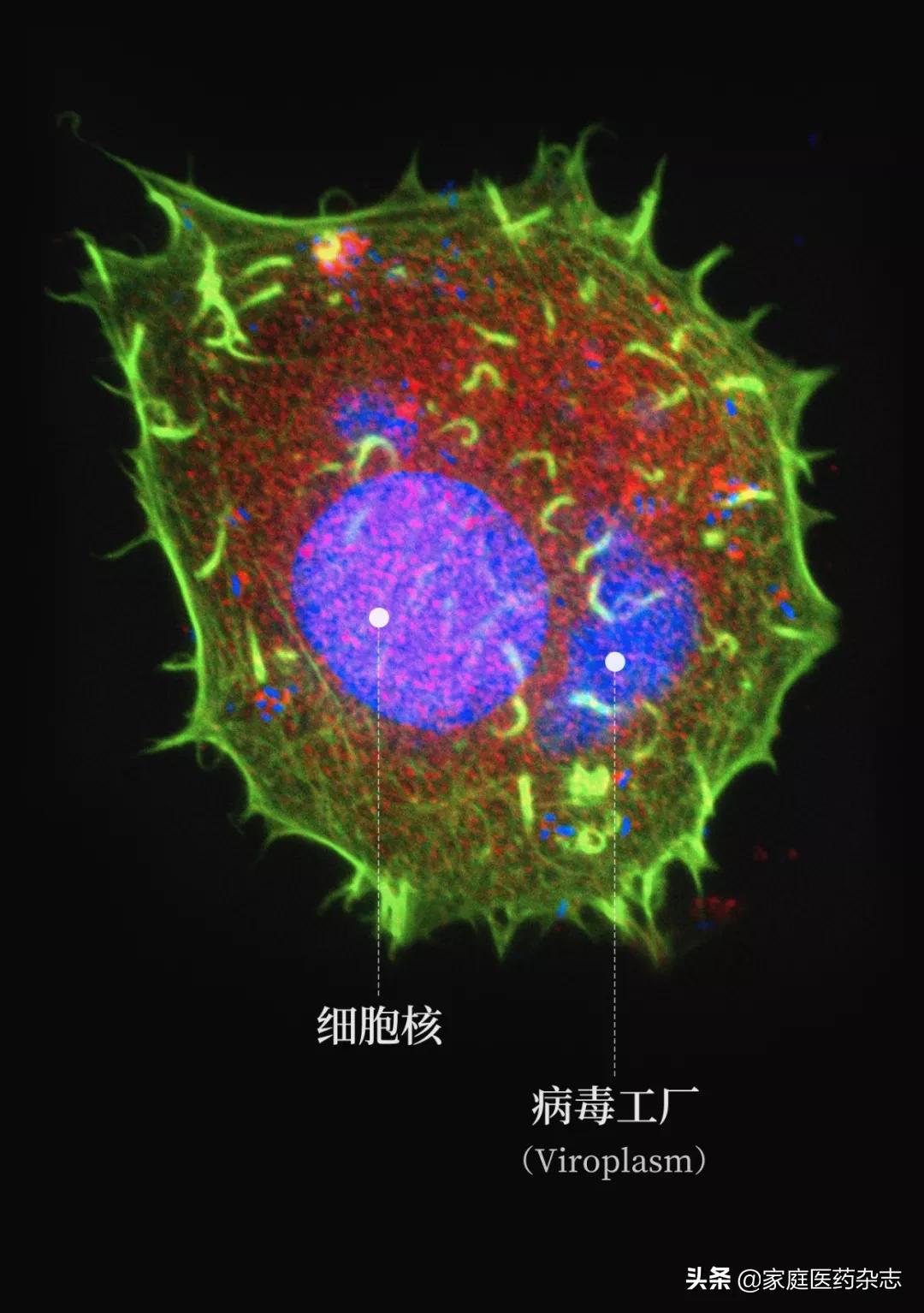 鍋囧鐥呮瘨鎰熸煋浜嗘垜,鍋囧鐥呮瘨鎰熸煋浜嗕綘