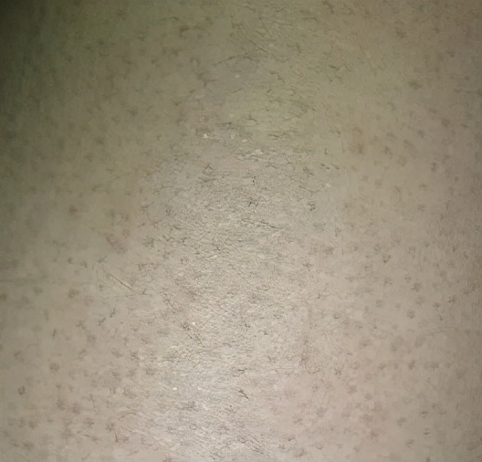 如何拥有好的皮肤教你这几招,怎样才能拥有白白净净的皮肤