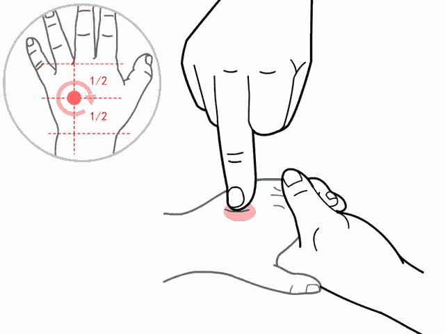 小儿疱疹性咽峡炎怎么治疗好得快,宝宝疱疹性咽峡炎怎么快速退烧