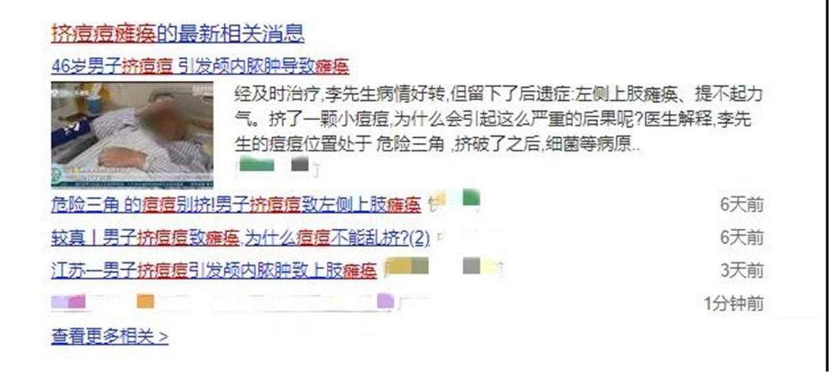 “危险三角区”的痘痘千万不能挤！有人挤了一下，结果留下后遗症