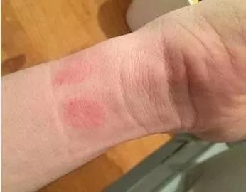 为什么戴银镯手腕一圈总发黑？