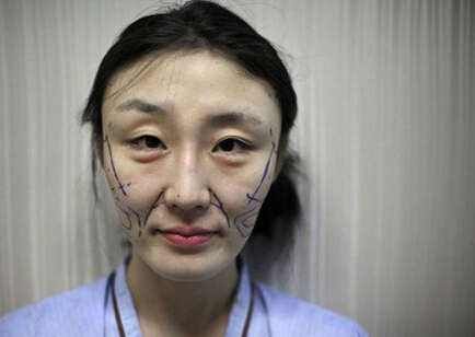 脸部微整形的危害,脸部微整形有什么危害