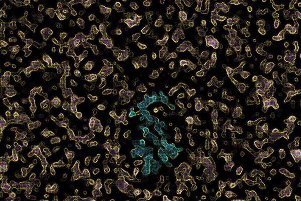 中医是如何辨证肝受损,肝好一切都好老中医治肝12种妙招