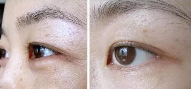 又好用又不贵的30岁以上的眼霜,25岁以上适合的平价眼霜