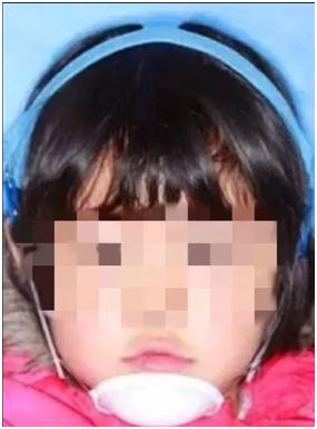 孩子嘴巴地包天有什么说法吗,小孩嘴地包天