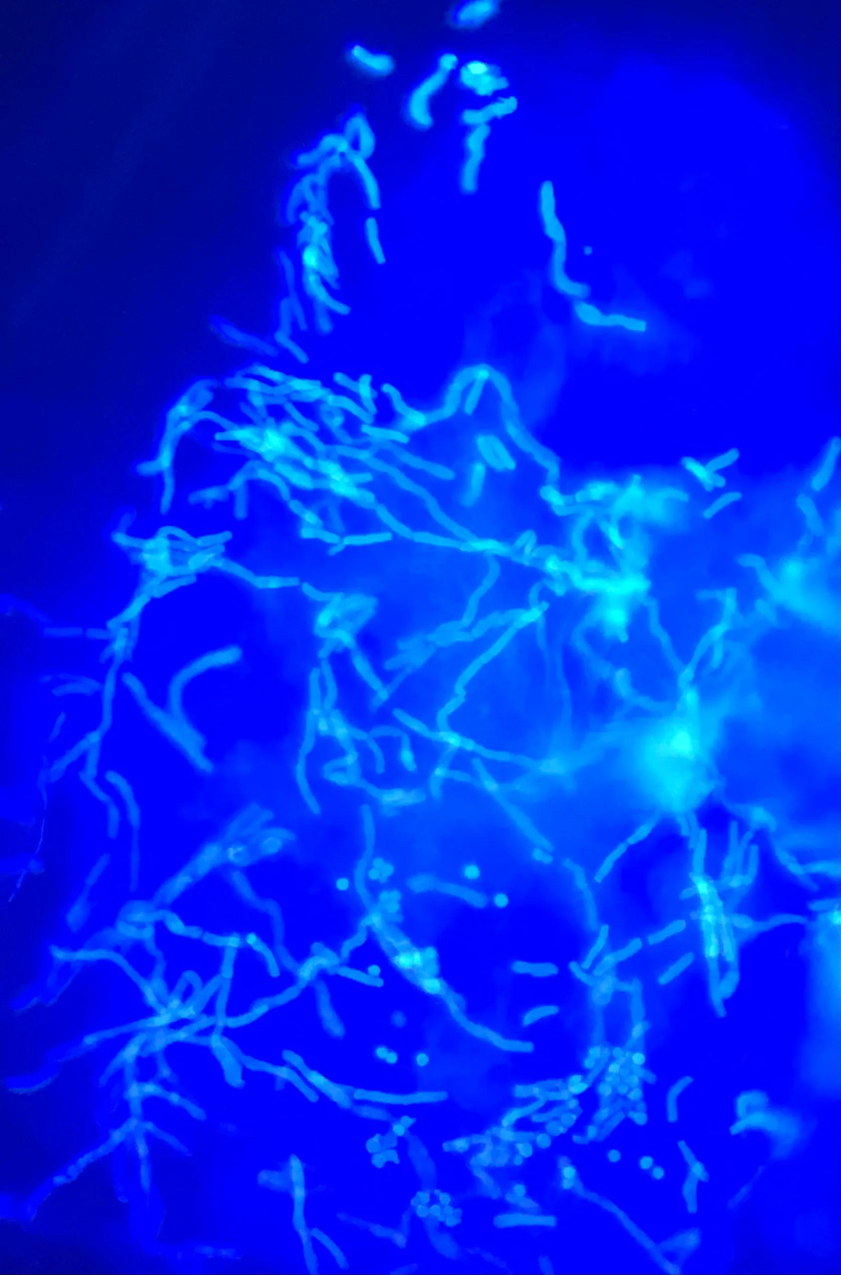 脚气足癣怎么治疗,脚气足癣能治愈吗