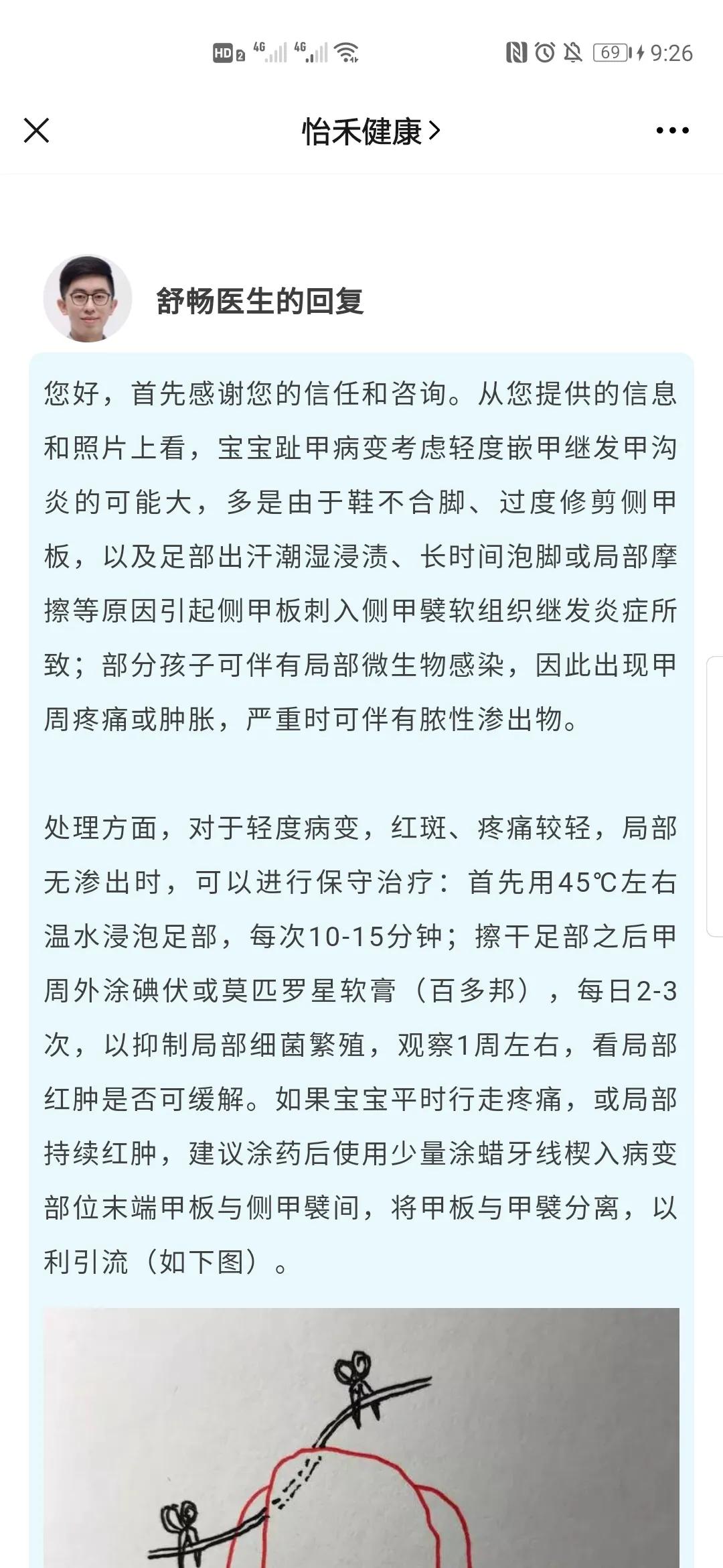 8个月未好的甲沟炎,小月龄甲沟炎症状
