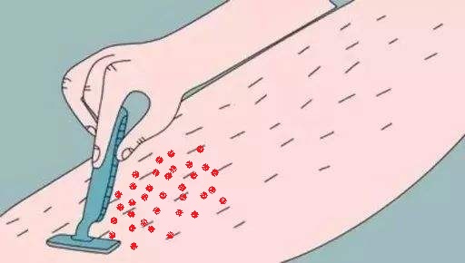 耳再造二期手术前多久脱毛,去医院脱毛前要先在家脱毛吗