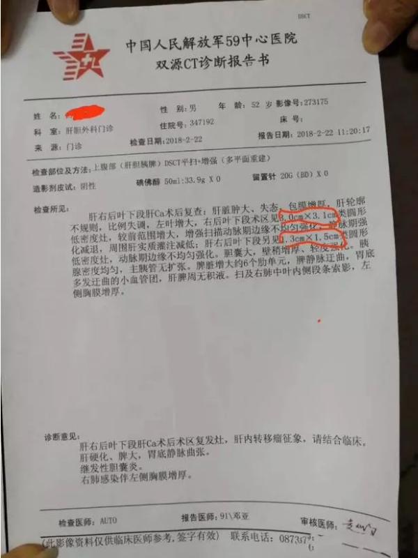 肝炎减轻肝负担,肝炎怕不怕
