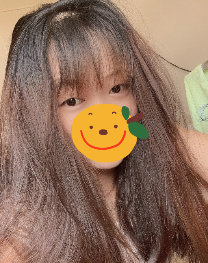 甲亢用碘131治疗变成甲减概率,甲亢做了碘131成为甲减的几率大吗