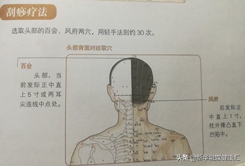 癫痫跟情绪有关系吗,癫痫并不可怕其实多半可以治愈