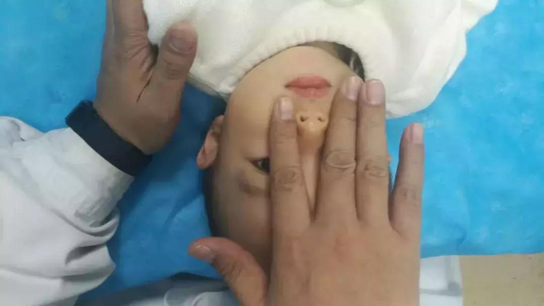 鼻炎与鼻窦炎的区别图解,鼻窦炎和鼻炎的对比