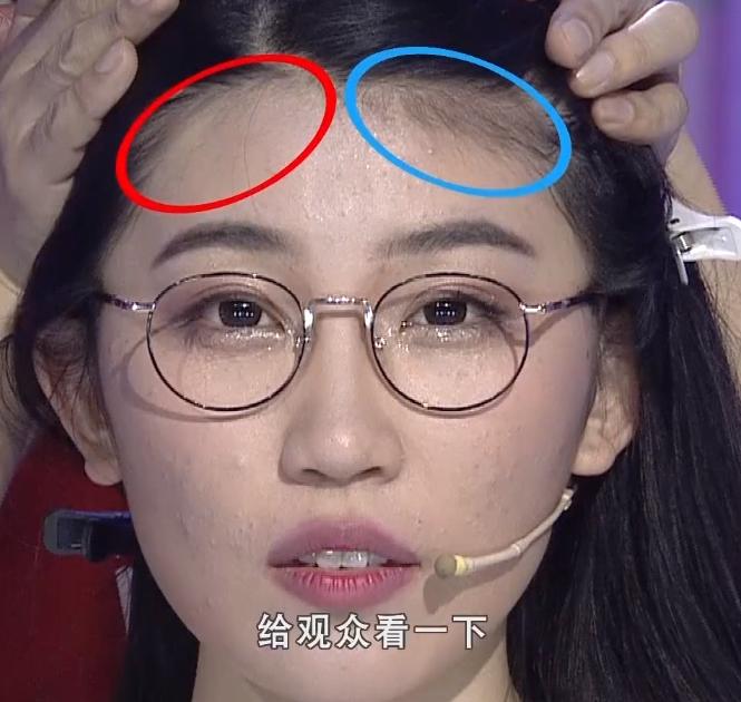 额头窄怎么办适合什么刘海,额头窄不好看怎么办