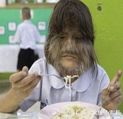 女孩身患“怪病”脸上长毛，男友原本不离不弃，剃发后竟然淡定不了？