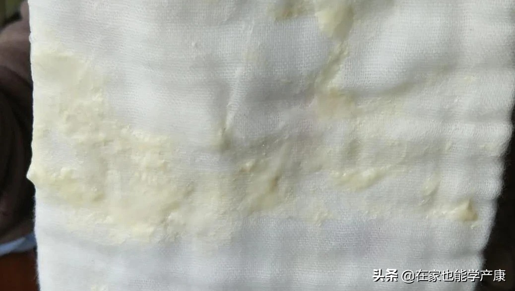 宝宝吐奶奶水豆腐渣,吐奶豆腐渣状20天宝宝