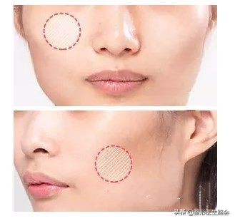 颧骨内推和颧弓有何区别,颧骨内推和颧突有什么区别