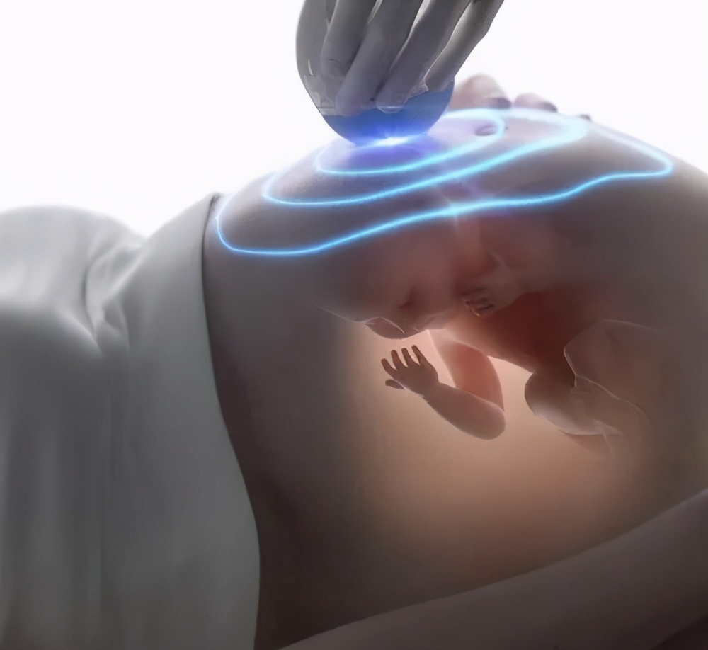 有没有在妇幼做四维彩超的,在妇幼保健院做四维彩超多少钱