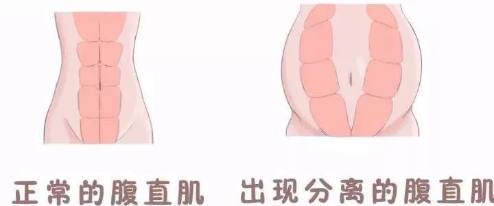 十月怀胎，我变成“小腹婆！”