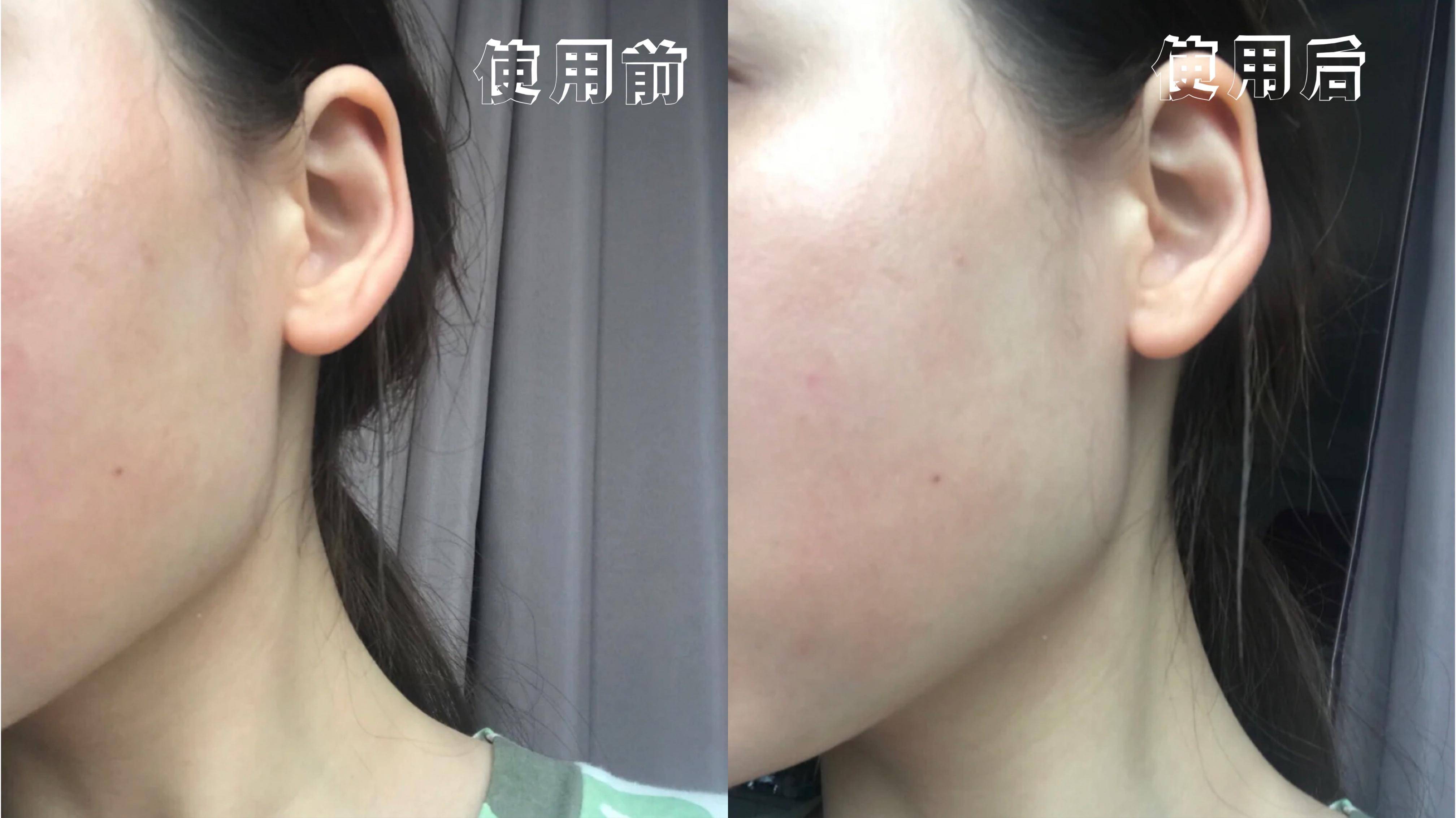 换季皮肤泛红面膜,换季期的面膜推荐