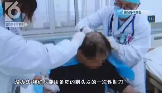 神操作!男子用敌敌畏洗头,医生“剃头”救命