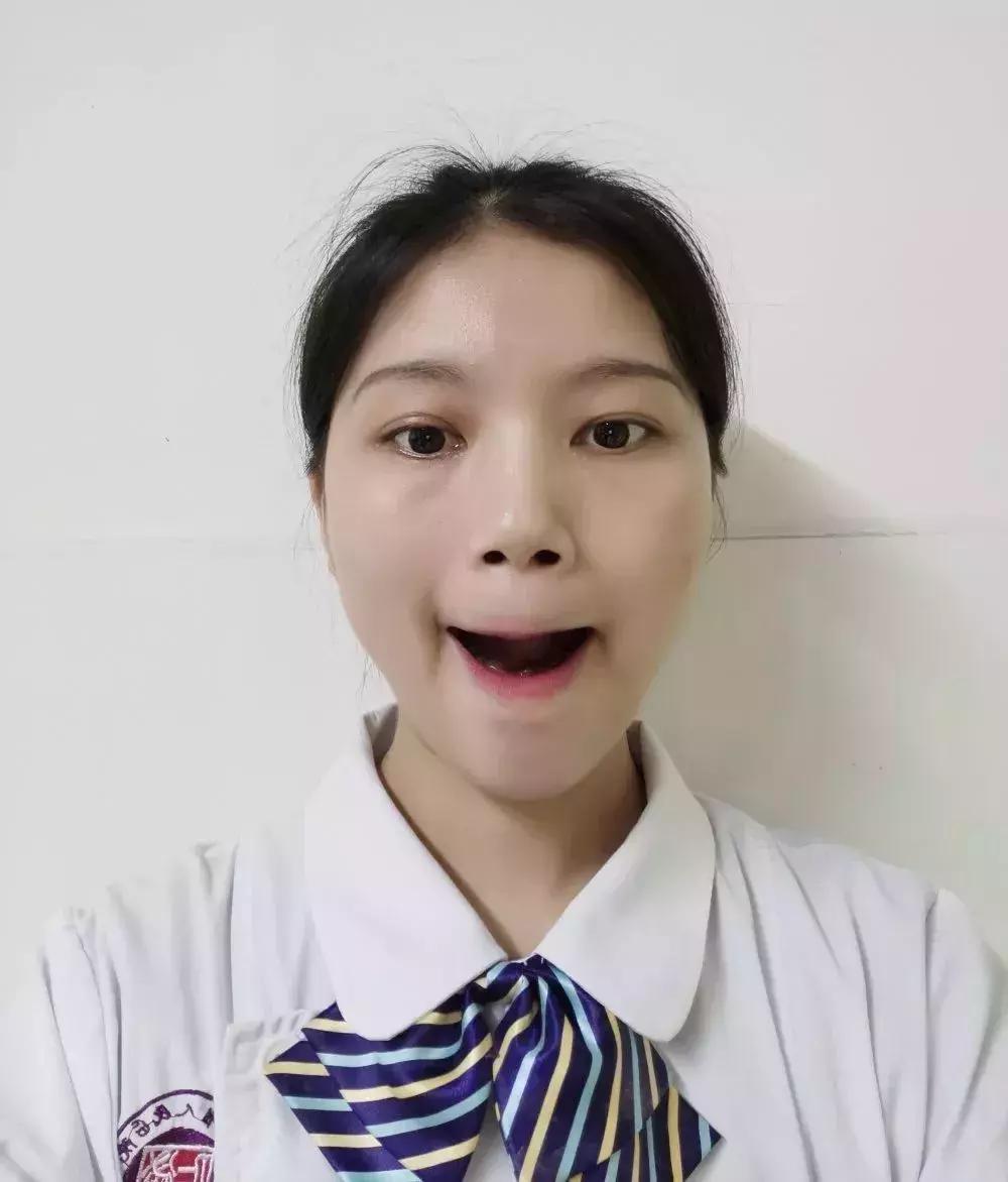 面瘫康复六个动作鬼脸操视频,面瘫鬼脸