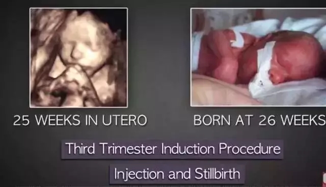 人流最多次案例,20岁女孩人流七次后续