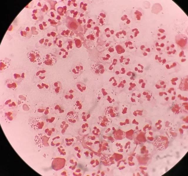 情人的眼泪后劲大,情人的眼泪前奏