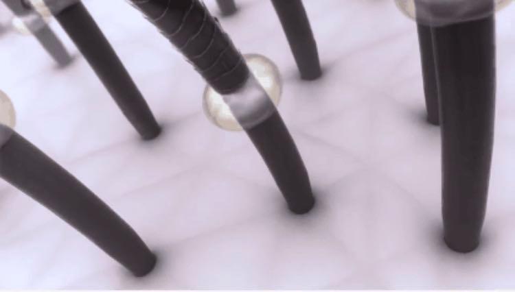 沙宣洗发水蓬松控油去屑,沙宣洗发水去油去屑推荐