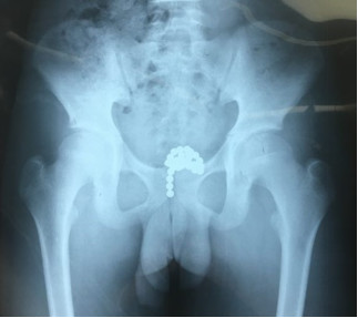 漂亮的玩具有什么,漂亮的玩具真的安全吗