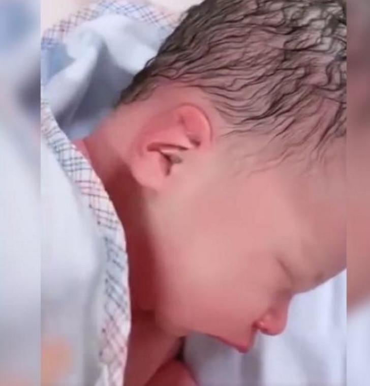 分娩时婴儿头部挤压怎样恢复,分娩时宝宝脑袋被挤压变形