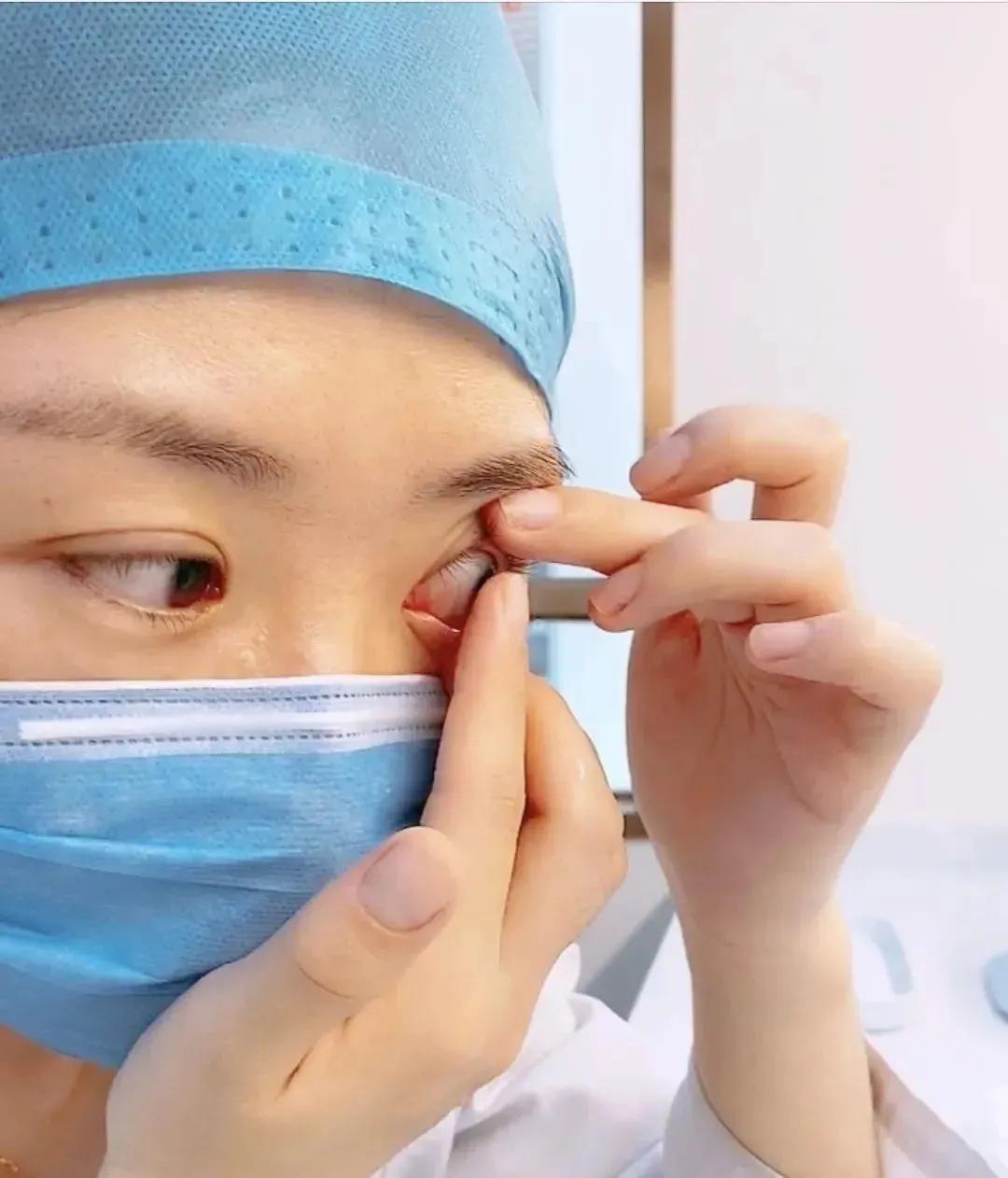 摘隐形眼镜有什么好方法吗,隐形眼镜怎样摘