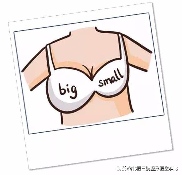 胸一边大小不一样很明显怎么办,大小胸适合穿什么文胸
