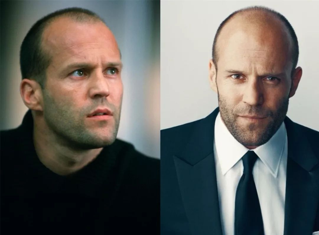 贝克汉姆脱发最新消息,大卫贝克汉姆脱发