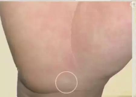 10种常见病对照表,100种常见病诊断