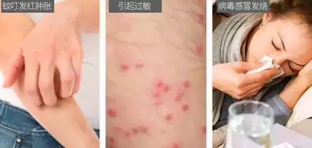 灭蚊神器怕蚊子的人赶紧入手吧,日本户外灭蚊器