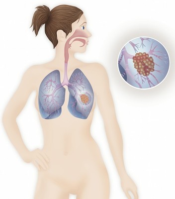 寒性体质怎么办？别担心，这5个办法来帮你