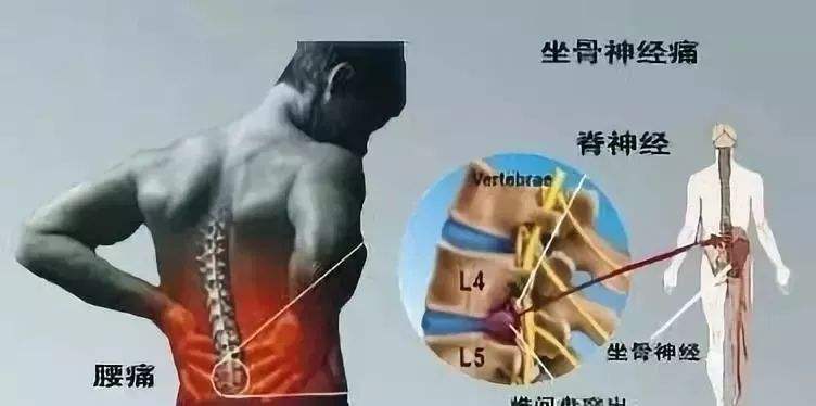 陈式太极拳虚灵顶劲,太极拳沉肩坠肘锻炼五脏