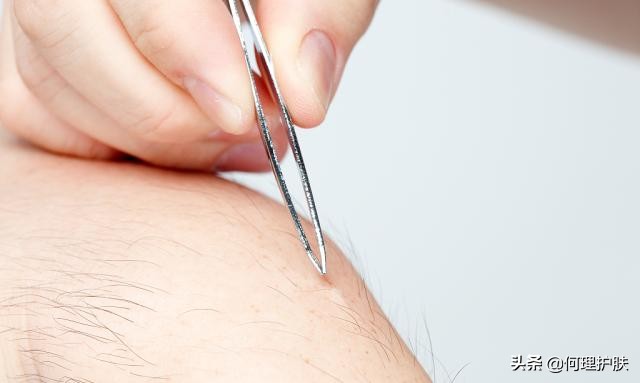 脱毛膏还是激光脱毛比较好,脱毛膏剃须刀