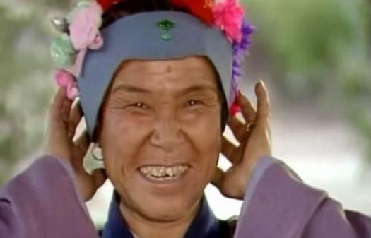 面对脱发如何调整心态,当代脱发的自救方法