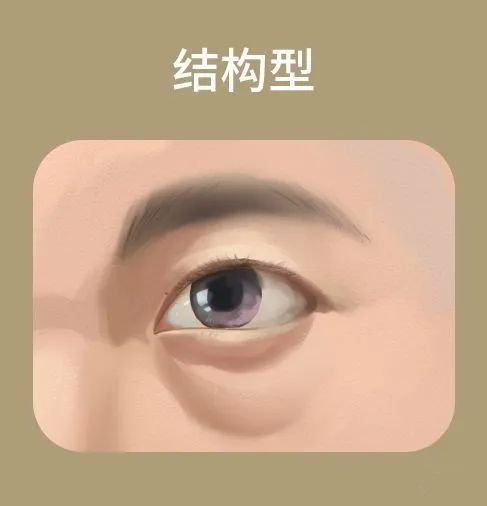 有了黑眼圈怎样改善并注意什么,有黑眼圈怎么才能让黑眼圈下去呢