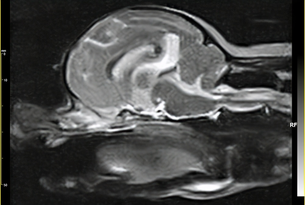 舌下神经受损症状图片,舌下神经损伤后的表现怎么治疗