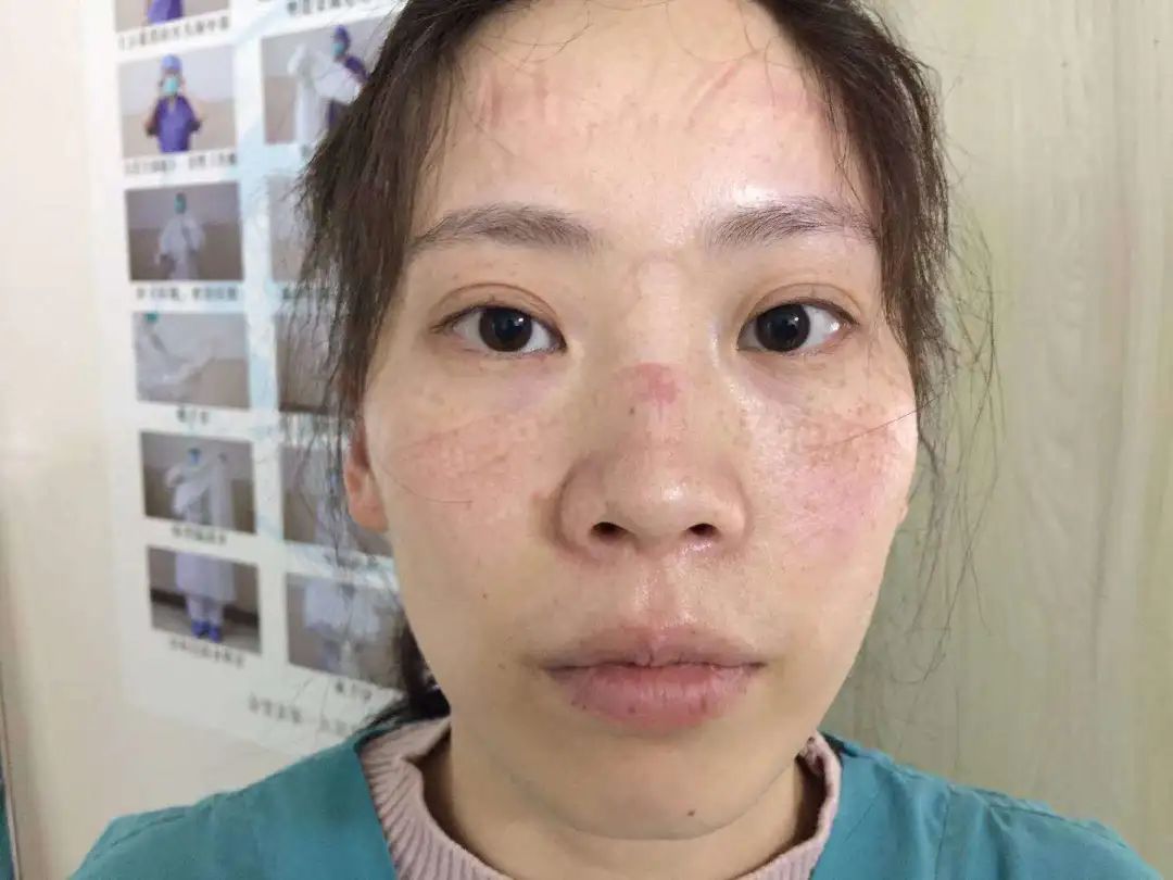 最美女人花|一起点赞，金堂抗疫玫瑰逆风绽放让人泪目