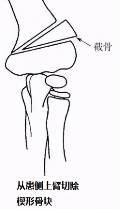 这个小伙子，胳膊肘真是往外拐的......