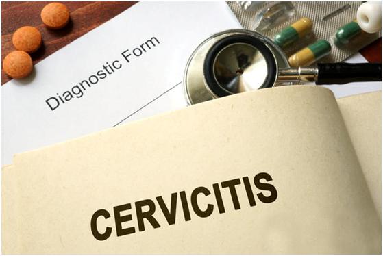 宫颈重度炎症可能影响怀孕,一定要注意