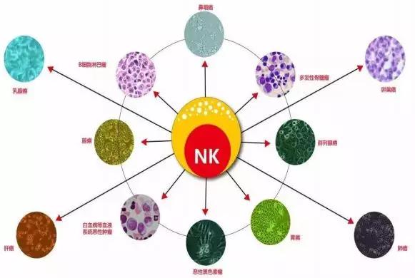 免疫治疗晚期癌症是怎么治疗的,细胞免疫癌症治疗方案