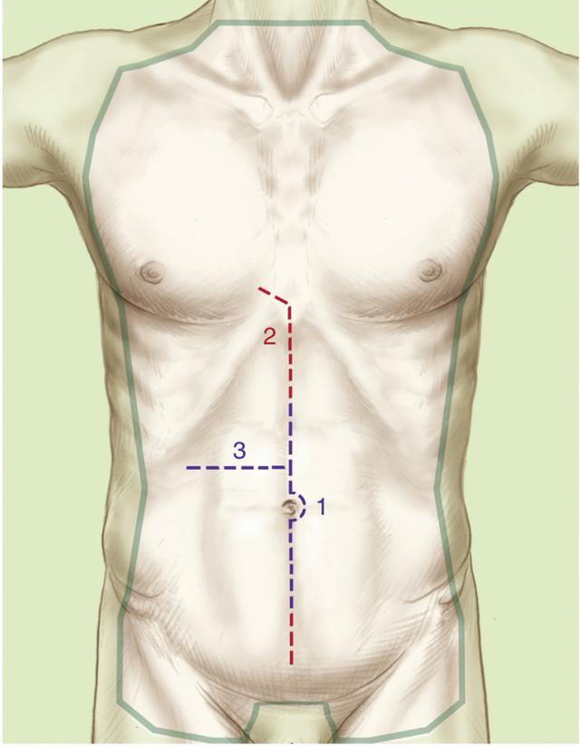 肝脏损伤的诊断和处理,肝脏损伤ii级