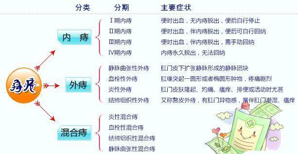 最新痔疮的手术治疗方法有哪些,目前痔疮手术最好的方法是什么