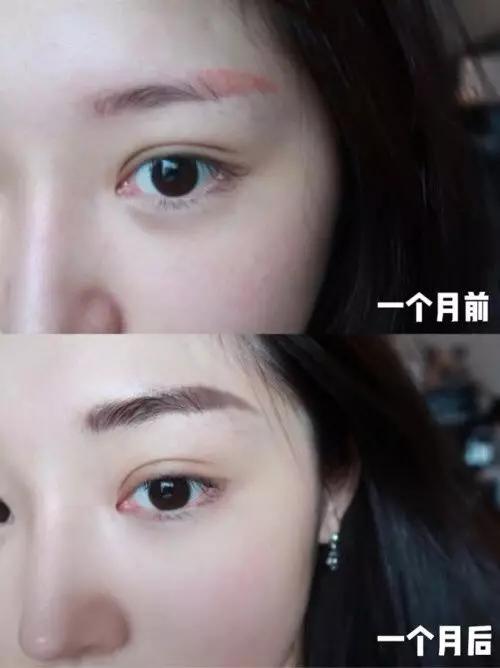 眼霜到底有没有用啊,眼霜里面有什么成分不能用