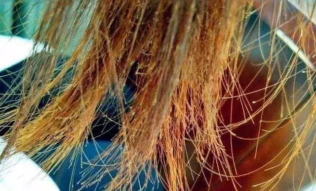 你的头发为什么会崩掉,头发干枯分叉怎么修复